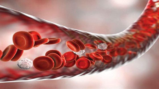 حموضة الدم.. الأعراض ، كيفية التشخيص والعلاج و طرق الوقاية