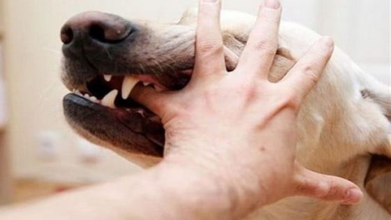 وفاة طفل بسبب داء ” السعار ” يجر وزير الصحة للمساءلة البرلمانية