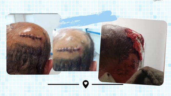 حادثة ميضار الطو: جروح بليغة ومبيت في المخفر