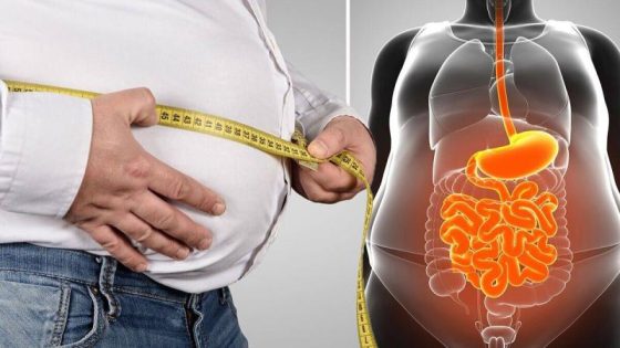 الدهون الحشوية… ما هي وكيف نتخلص منها؟